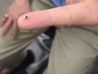 Le plus petit pacemaker au monde